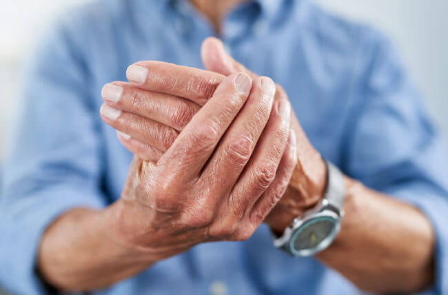 osteoarthritis patológia osteoarthritis orvosi kezelése